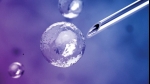 10 Things You Need To Know About Regenerative Stem Cell Therapy