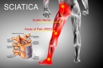 3 Simple Stretches for Sciatica Pain Relief