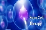 5 Benefits of Stem Cell Therapy