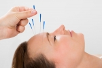 Acupuncture For Long-Term Pain Relief For Migraine Sufferers