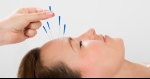 Acupuncture For Long-Term Pain Relief For Migraine Sufferers