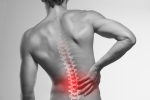 Back Pain and Spinal Cord Stimulation