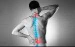 Back Pain Myths