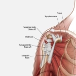 Exercises To Rehab A Rotator Cuff Injury