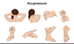 Can Acupressure Relieve Headaches?