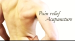 Can Acupuncture Solve Your Pain Problem