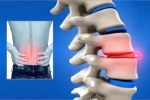 Can Herniated Discs Heal on Their Own?
