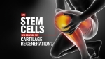 Can Stem Cells be a Solution for Cartilage Regeneration?