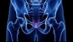 Causes of Coccydynia (Tailbone Pain)