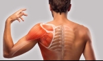 Causes of Pain Under Your Shoulder Blade