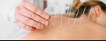 CMS Looking at Acupuncture for Back Pain