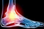 Could Foot Pain Be Caused by Your Spine?