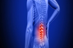 Diagnosing Lower Back Pain