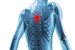 Diagnosing Upper Back Pain