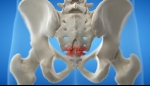 Diagnosis of Coccydynia (Tailbone Pain)