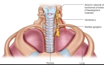 Ease Your Neck Pain With a Stellate Ganglion Block