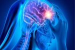 Health And Wellness: Medical Myths About Migraine Misunderstandings