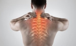 How a Herniated Disc in Your Upper Back Causes Pain, Numbness, and Weakness