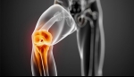 How Stem Cell Injections Heal Damaged Knees