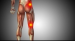 How to Use Ice to Cool Down Your Sciatica Symptoms