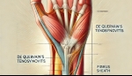 Managing De Quervain’s Tenosynovitis Through Interventional Pain Care