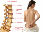 Myths about Causes of Back Pain/Problems