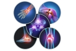 Non-Surgical Solutions for Arthritis Pain