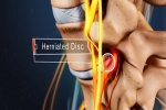 Non-Surgical Treatment for a Lumbar Herniated Disc