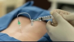 Pain Management: Epidural Injection