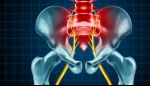 Pain Management: Sacroiliac Joint Dysfunction