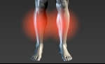 Pain Management: Shin Splints