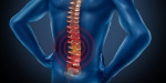 Pain Management: Spinal Arthritis