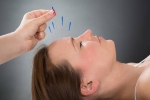 Pain Relief - Acupuncture Over Opioids