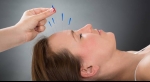 Pain Relief - Acupuncture Over Opioids