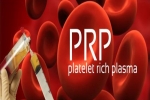 PRP – Platelet Rich Plasma treatments in Long Island & Queens, New York