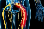 Sciatica – What It Is & What You Can Do?