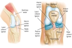 Sports Medicine: Partial and Complete Tears of the ACL - Anterior Cruciate Ligament