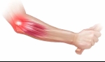 Stem Cell & PRP Procedures for Elbow Injuries, Overuse Conditions and Arthritis