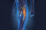 Stem Cell & PPR Procedures for Hip Injuries, Arthritis, Bursitis and Other Degenerative Conditions