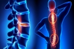 Stem Cell & PPR Procedures for Low Back Pain and Spine Conditions
