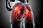 Stem Cell Treatment for Hip Pain - Alternative to Hip Replacement Surgery