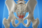 Symptoms of Coccydynia (Tailbone Pain)