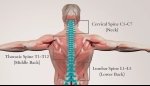 Cervical, Thoracic, or Lumbar Sprain or Strain