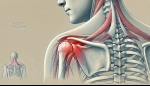 Frozen Shoulder (Adhesive Capsulitis) and Its Management