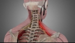 Nerve Impingement (Radiculopathy) and Its Management
