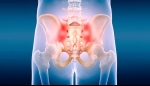 Sacroiliac Joint Dysfunction and It’s Treatment