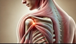 Shoulder Sprain and Strain: Effective Pain Management Approaches