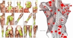 What Are Trigger Points and Why Do They Matter?