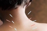 What happens during an Acupuncture treatment?
