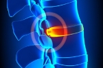 What Is Degenerative Disc Disease?